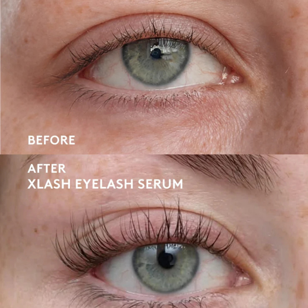 XLASH Eyelash Serum – ripsmeteseerum, 3 ml