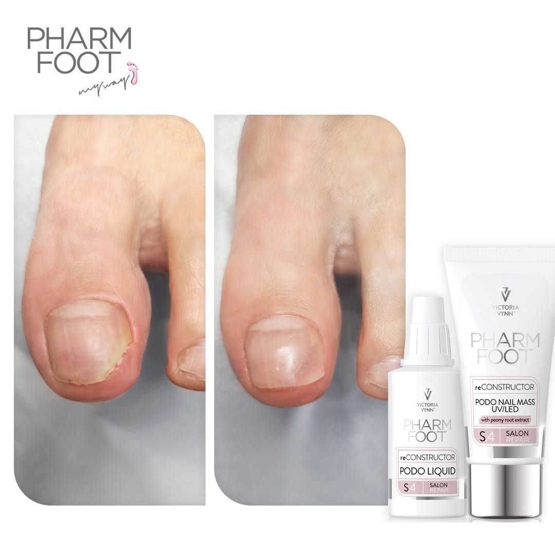 PHARM FOOT Реконструктор ногтей,  reConstructor Podo Nail Set UV/LED