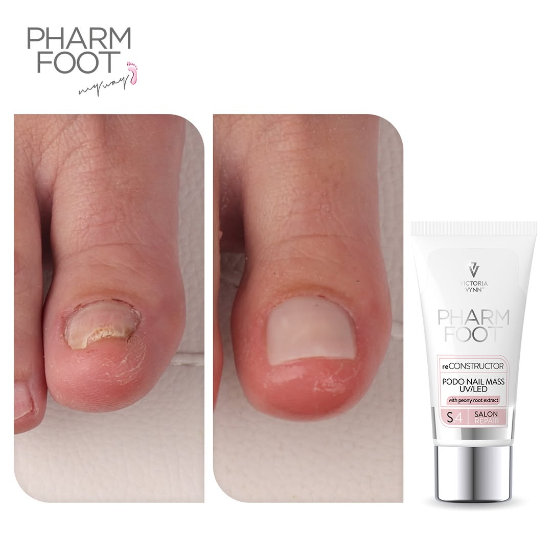 PHARM FOOT Реконструктор ногтей,  reConstructor Podo Nail Set UV/LED