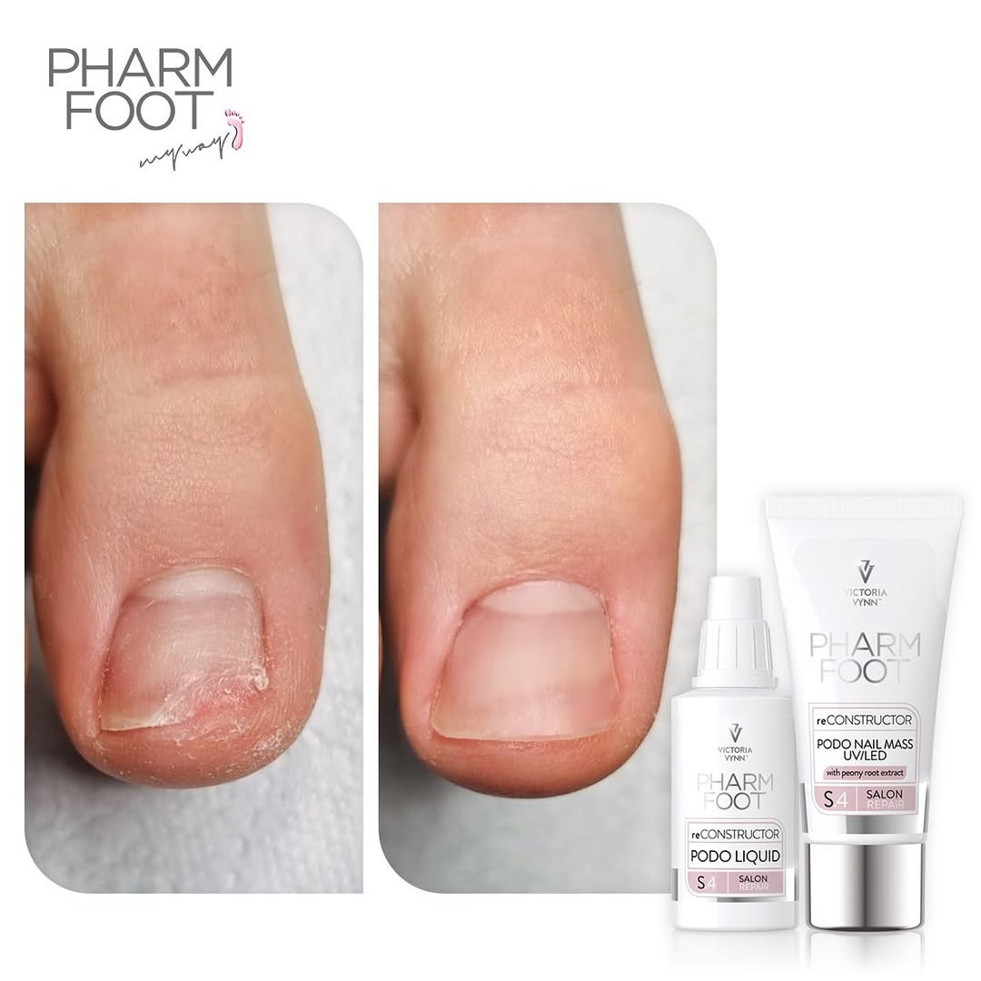 PHARM FOOT Реконструктор ногтей,  reConstructor Podo Nail Set UV/LED
