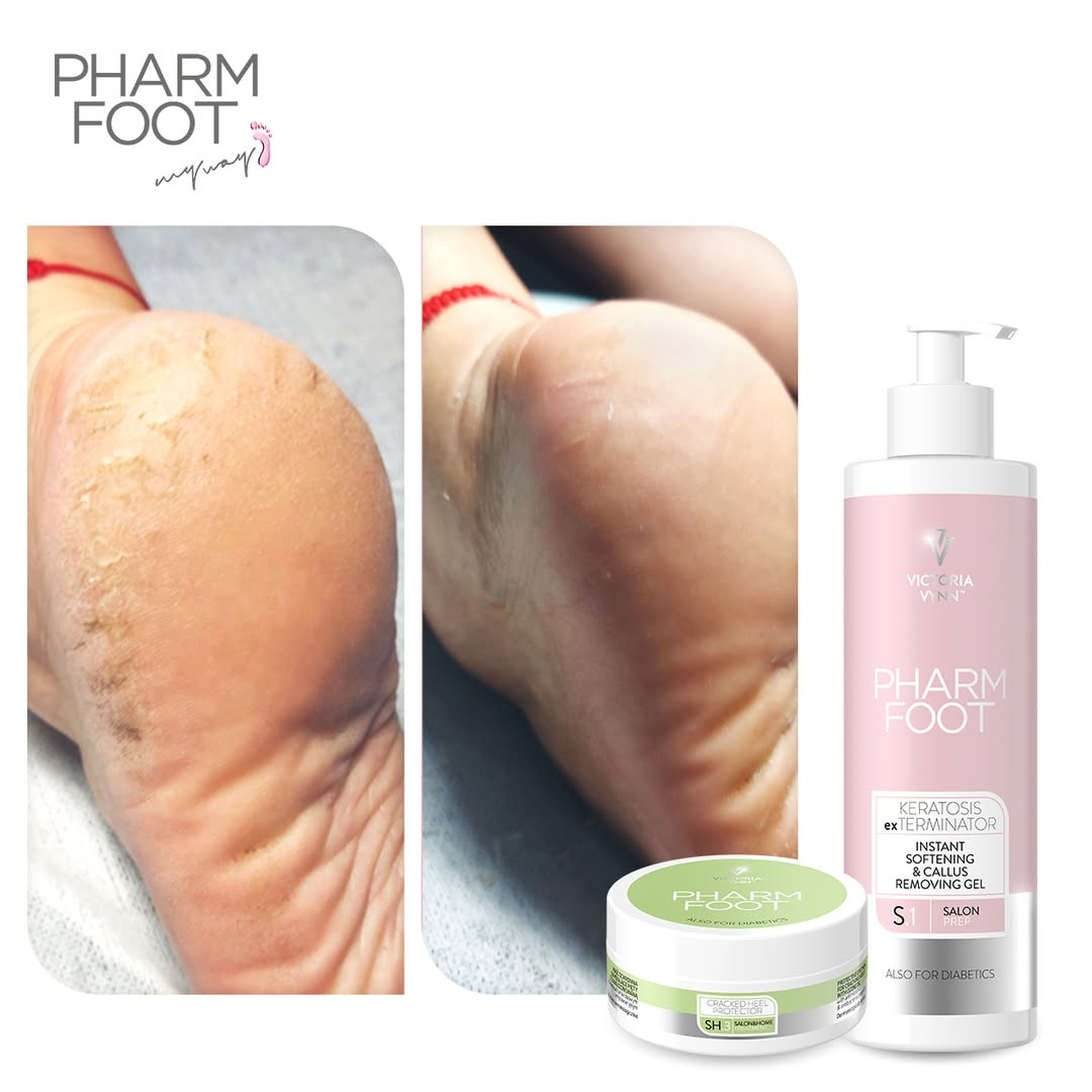 PHARM FOOT Набор для ухода за потрескавшимися пятками и кожей стоп