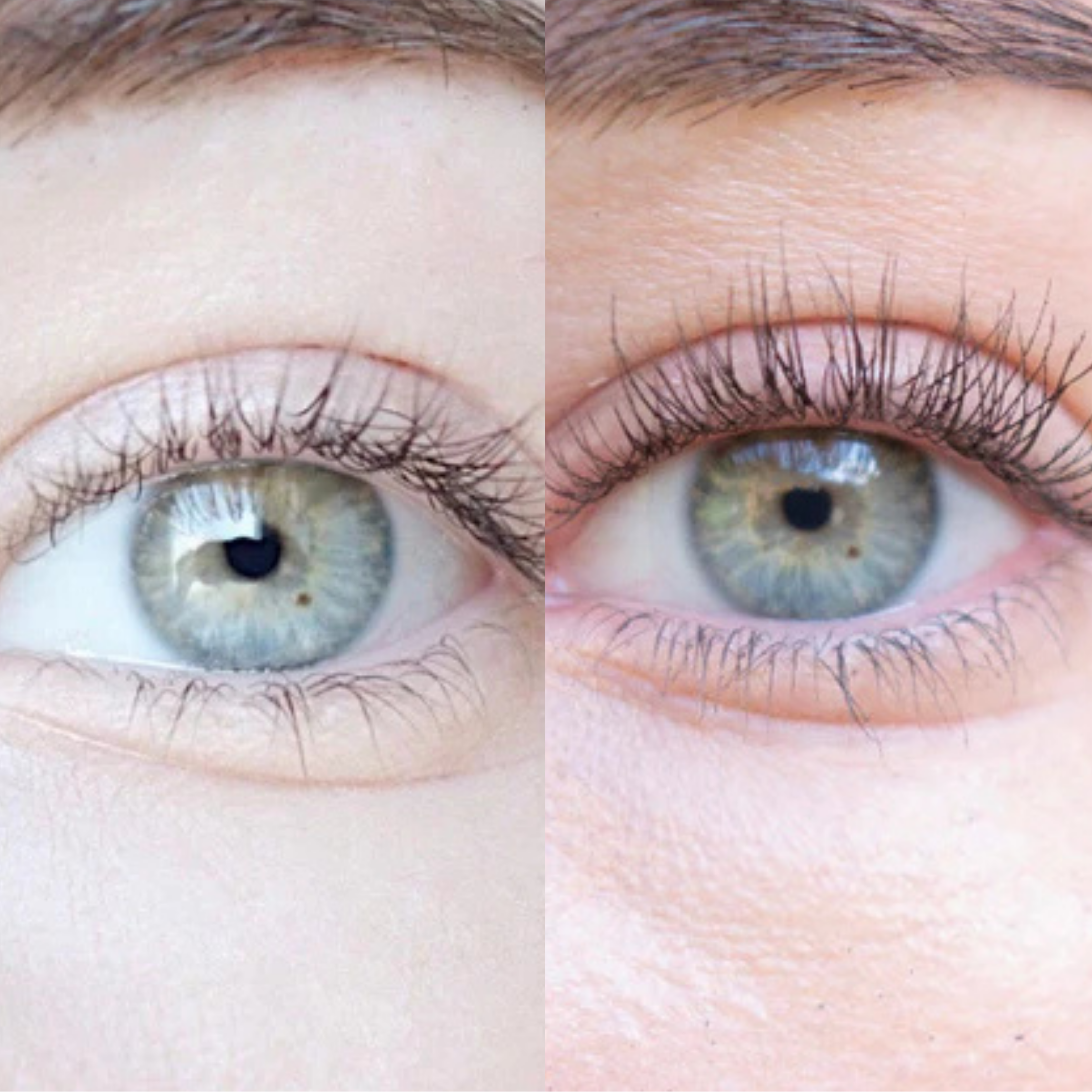 XLASH Eyelash Serum - skropstu serums, 5ml