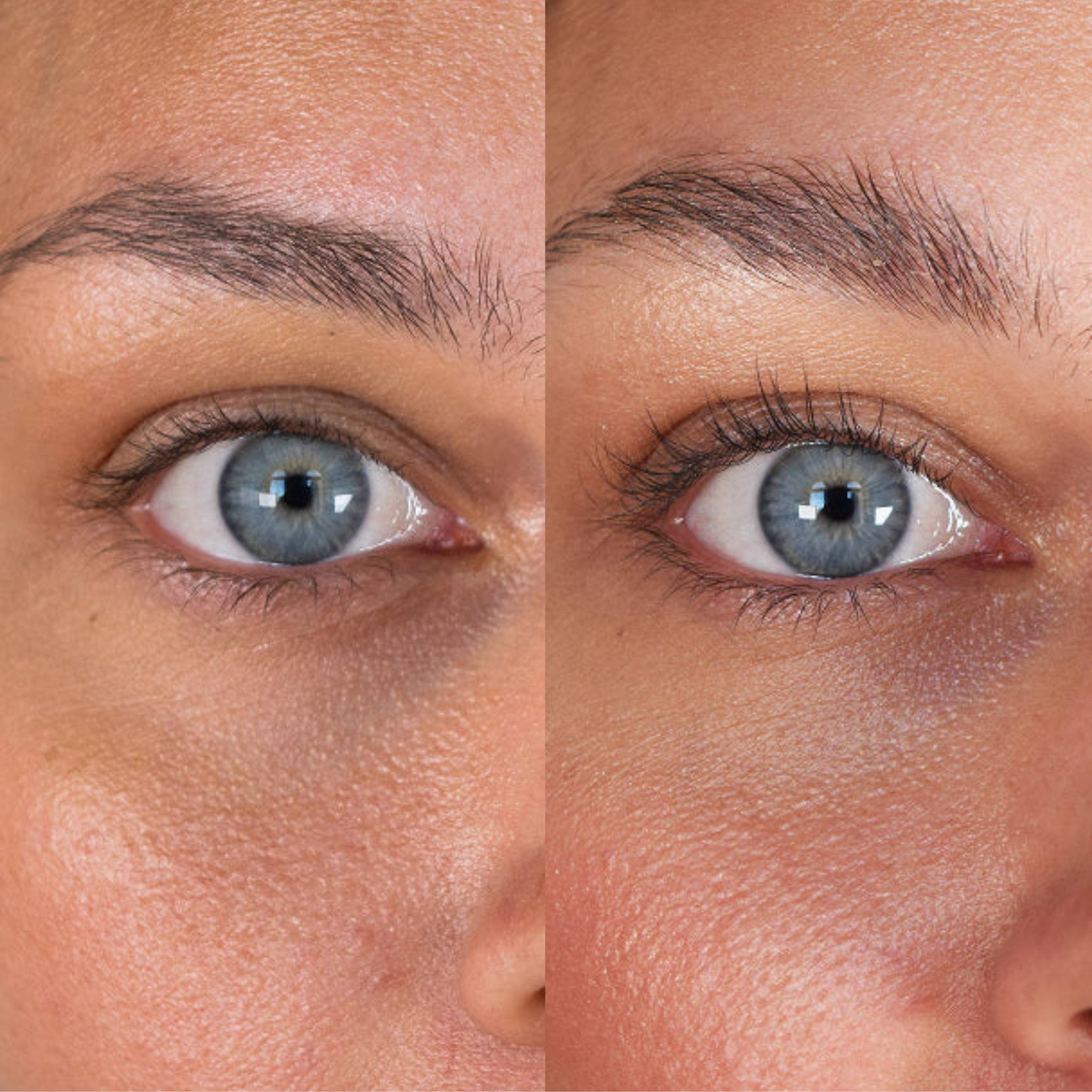 XLASH Eyelash Serum - skropstu serums, 5ml