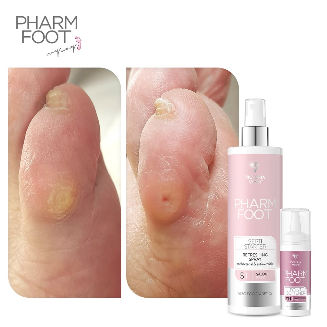 PHARM FOOT Komplekts varžacu noņemšanai