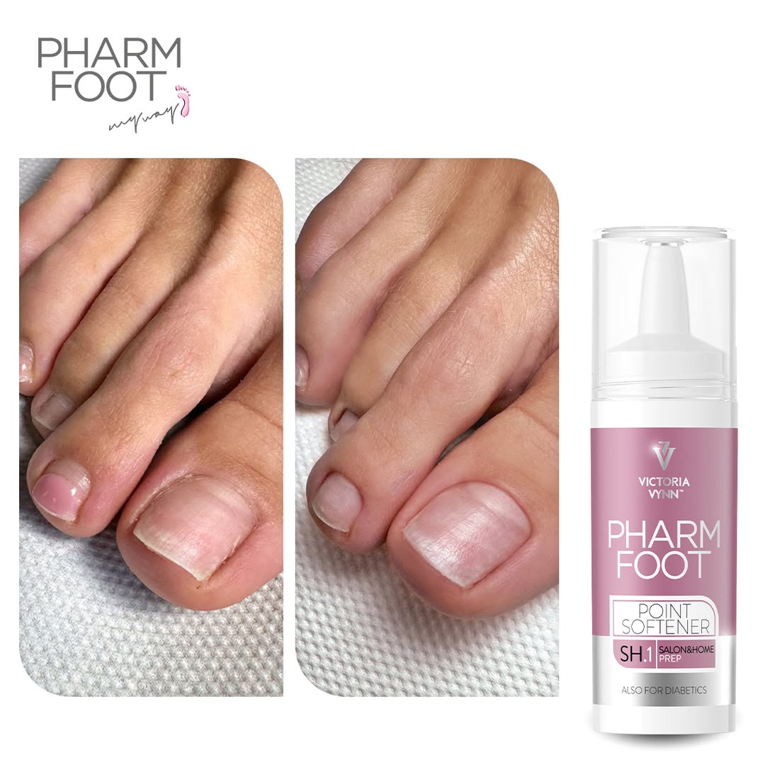 PHARM FOOT Флюид для вросших ногтей и мозолей, POINT SOFTENER 15ml